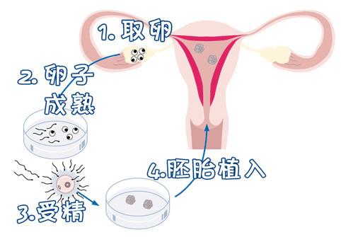 生殖妇科